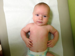 4 month checkup